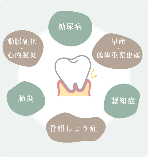 歯周病治療